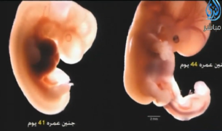 معجزة نبوية في حديث الجنين في الليلة 42 - انظر إلى ليلة نفخ الروح في الجنين